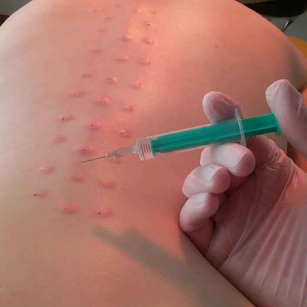 Nöral Terapi - Kategori